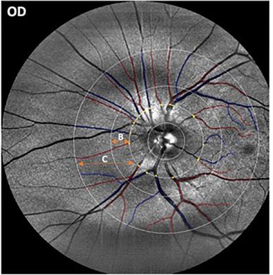 Investigating Multimodal Diagnostic Eye Biomarkers of Cognitive Impairment by Measuring Vascular and Neurogenic Changes in the Retina